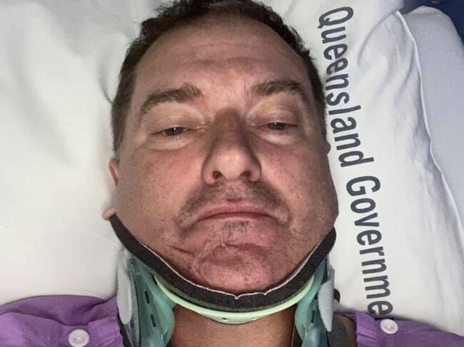 The MP said he will need to wear a neck brace for six weeks.