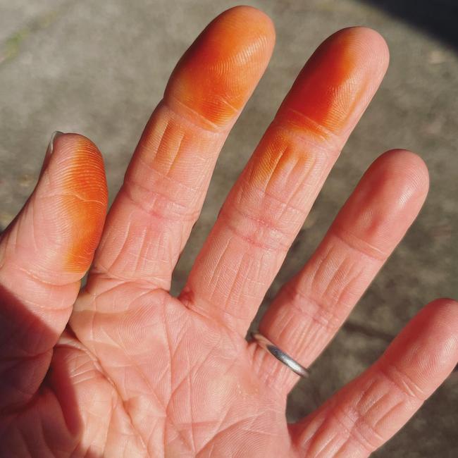 Deborah Knight shared a picture after her fingers turned yellow while removing a ‘disgusting critter’. Picture: Instagram/DeborahKnight