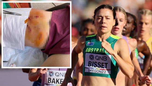 Catriona Bisset leg injury athletics