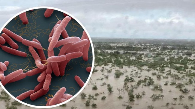 Three people in Darwin have contracted melioidosis this Wet season so far.