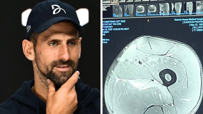 Novak Djokovic shared an MRI of his injured hamstring. Image: Getty/X