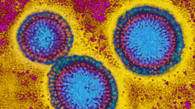 An electron microscope image of the influenza virus. Picture: Getty