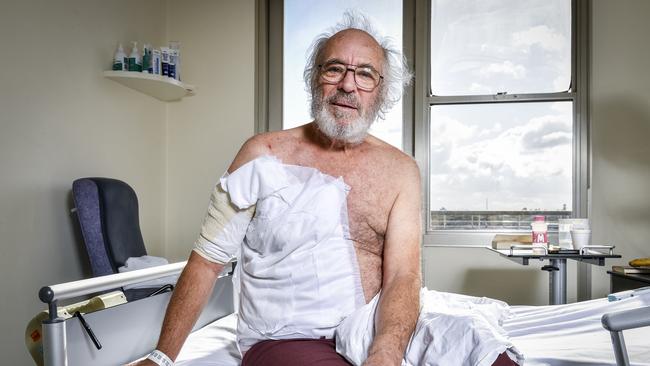 Greg Crowder recovers in the burns ward at the Alfred Hospital after he accidentally set himself on fire while using an angle grinder (2020). Picture: Jake Nowakowski