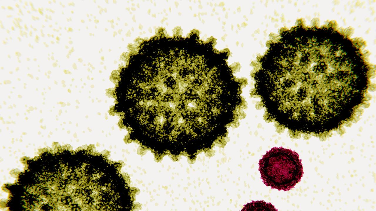 Poliovirus is a simple RNA virus 30 nm in diameter. Poliovirus causes poliomyelitis.