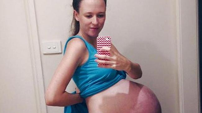 Xxpregnancy - Woman's pregnancy selfie ends up on 'preggophilia' fetish porn site |  news.com.au â€” Australia's leading news site