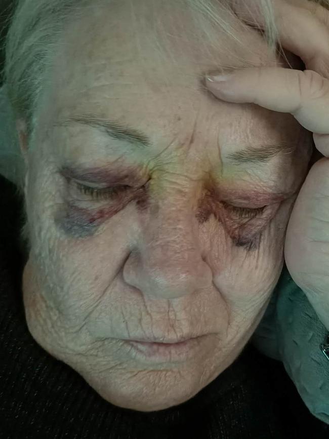 Christine Smith’s assault was instrumental in creating tougher penalties. Picture: supplied