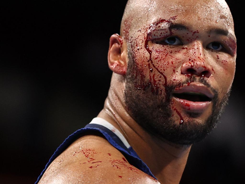 Blood pours from Britain's Frazer Clarke as he fights Uzbekistan's Bakhodir Jalolov during their men's super heavy (over 91kg) semi-final boxing match. Picture: Buda Mendes / POOL / AFP