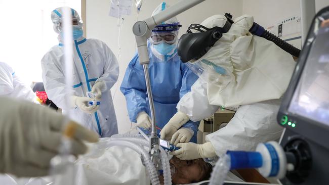 A critical patient infected with Covid on an ECMO machine. Picture: STR / AFP