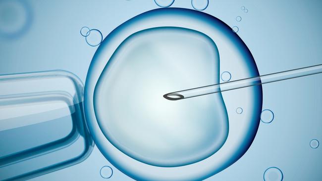 Under the HSU’s campaign, reproductive leave would be made available to workers of all genders, for things like IVF, severe menstrual pain, vasectomies and screenings for prostate cancer and breast cancer. Picture: iStock