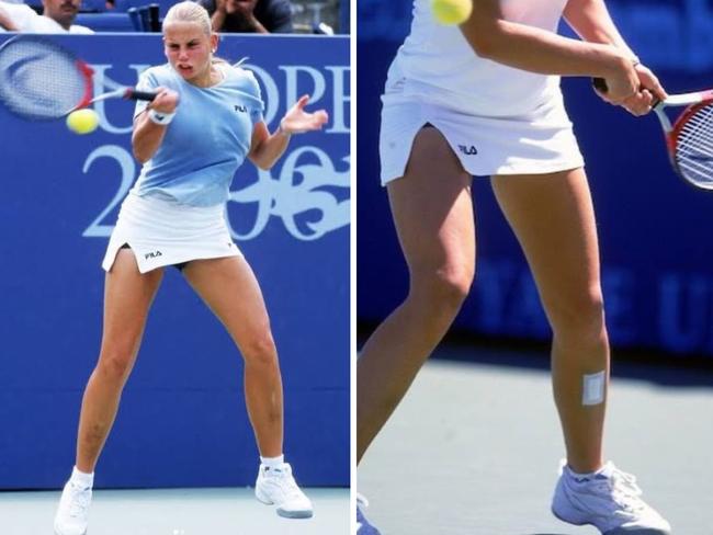 In 2023, Dokic shared physical injuries she played with, revealing she suffered regular beatings with a belt or a hard-capped boot, including one incident which saw her knocked unconscious. Photo: Instagram