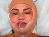 Star unveils drastic cosmetic surgery