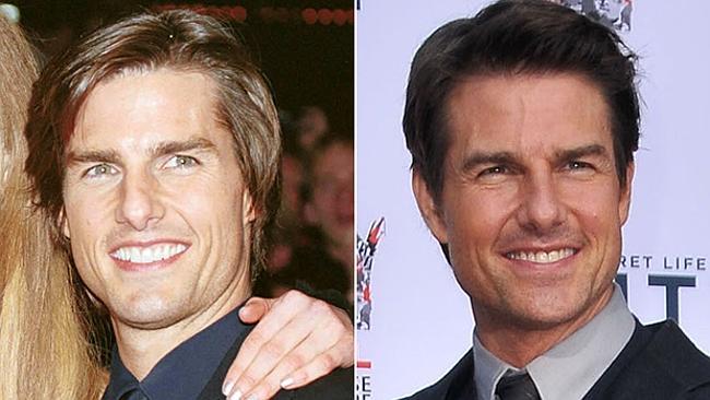 Tom Cruise in 1999 compared to 2013. Don’t get us wrong, he still looks good.