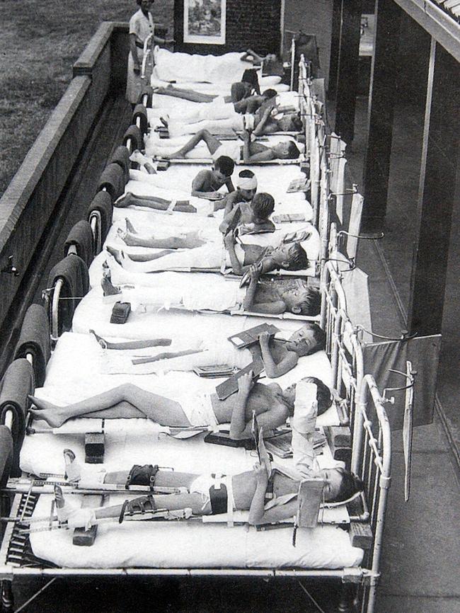 Children receive heliotherapy treatment for polio at the hospital’s orthopaedic section in Mt Eliza. Picture: Royal Children's Hospital Archives