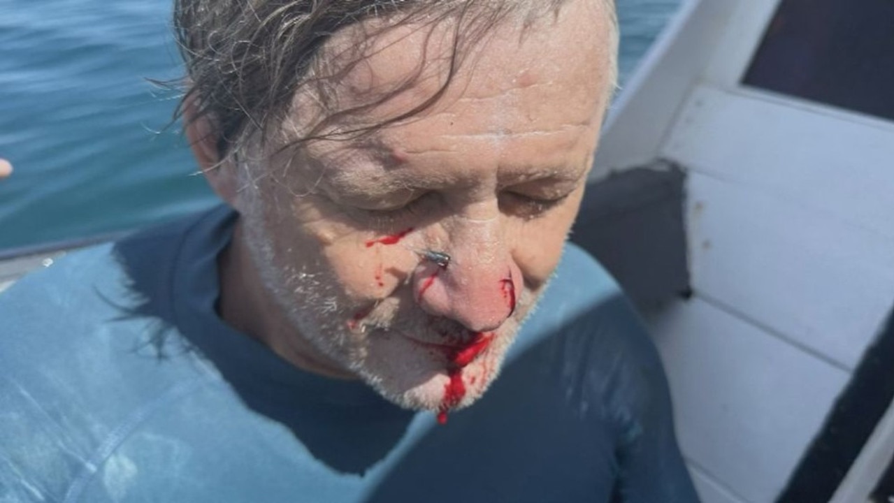Surfer Steve Kazic was enjoying the remaining days of his holiday until a crazy fish encounter postponed his plans. Picture: Supplied