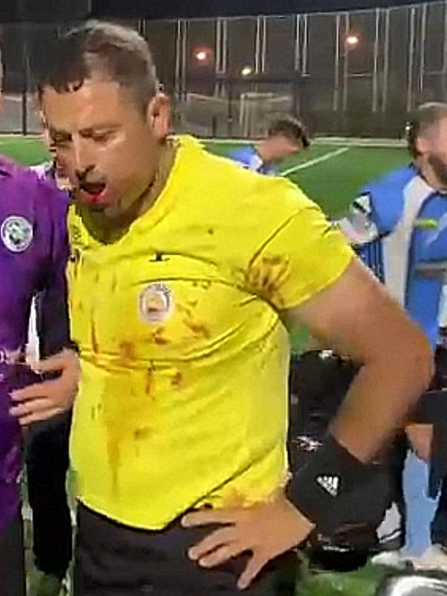 Referee Khodr Yaghi jaw was broken in the attack. Picture: video screengrab