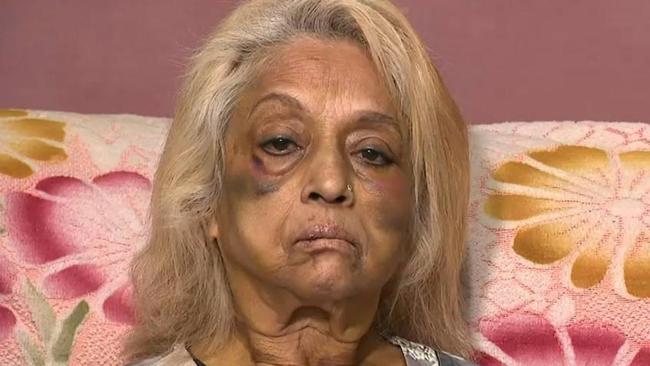 Ninette Simons, the victim of an assault and burglary in the Perth suburb of Girrawheen