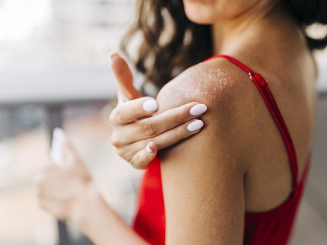 Skin expert shares 8 tips to fight against skin cancer and melanoma. Picture: Getty images