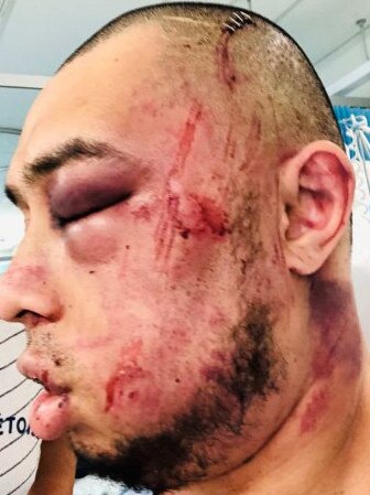 David Laipato was attacked inside Canberra's Alexander Maconochie Centre. Picture: Supplied