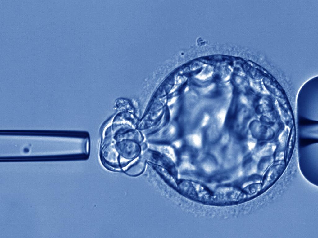 Scientists have developed a non-invasive embryo screening test to reduce miscarriages. Picture: Supplied