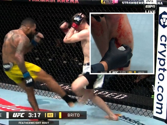 Jack Shore's leg was absolutely devastted. Photo: Main Event.