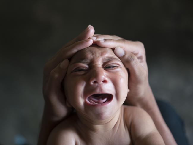Elielson Wesley tries to calm down his baby brother Jose. Jose was born with microcephaly and he screams uncontrollably for long stretches, getting red in the face and tightening his already stiff limbs. Picture: Felipe Dana