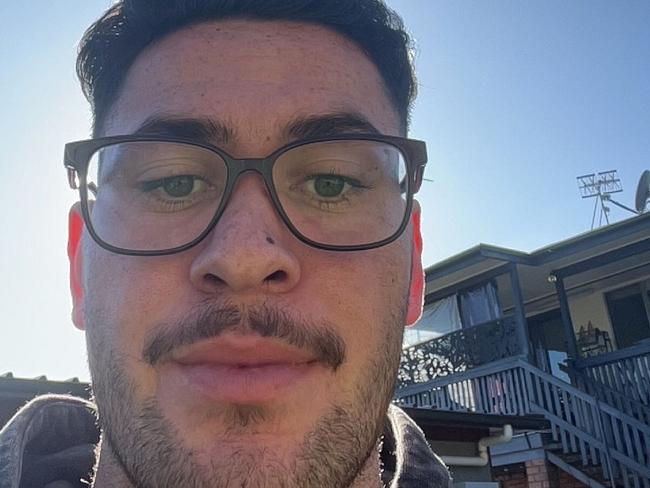 The 21-year-old is coming to terms with his disability. Picture: Supplied