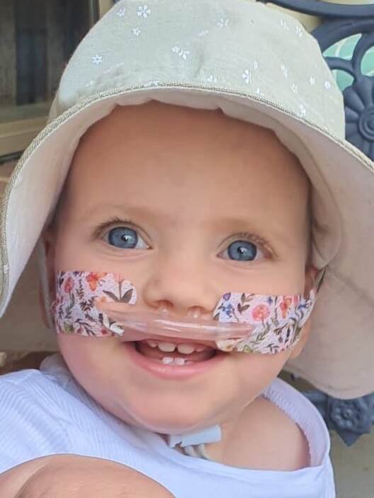 Adelaide premature baby Sophie Connor, now 3, Pictures, supplied by Connor family.