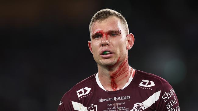 SYDNEY, AUSTRALIA - AUGUST 30: Tom Trbojevic of the Sea Eagles is assisted by a trainer after an injury and a head cut during the round 26 NRL match between Canterbury Bulldogs and Manly Sea Eagles at Accor Stadium on August 30, 2024, in Sydney, Australia. (Photo by Cameron Spencer/Getty Images)