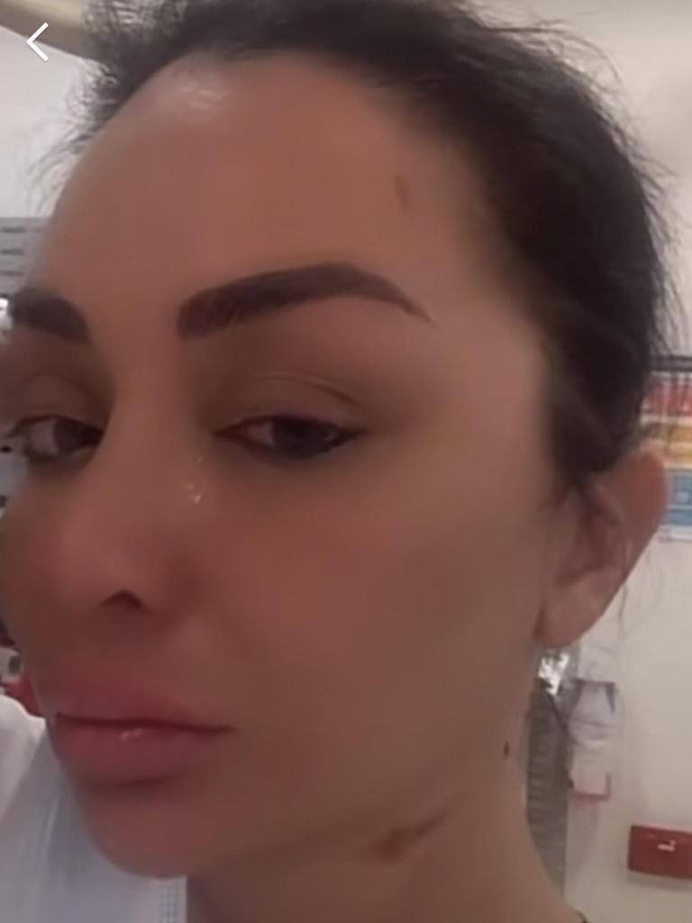 Jenny Elhassan in hospital after the alleged attack. Picture: TikTok