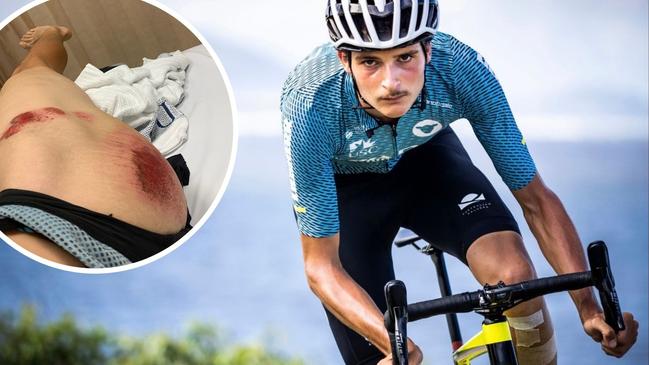 Australian Cycling Academy rider Daniel Di Domenico, 20, has recounted the moment he collided with a car along Frizzo Road, Palmview. Picture: Contributed