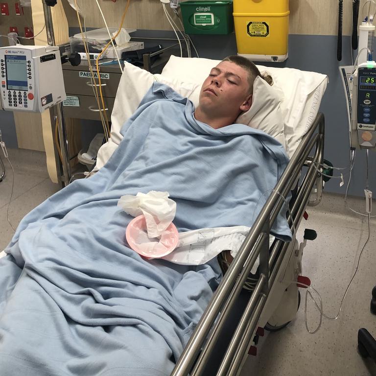 Mount Marlow teenager Max Baker was stung by an Irukandji jellyfish at New Beach on April 8, 2022. Picture: Michelle Baker