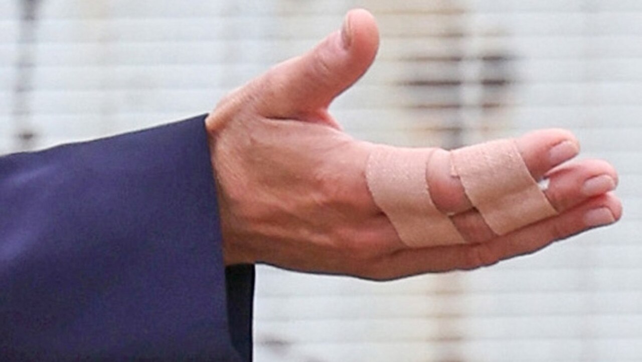 Zoom and enhance showed the Princess of Wales taped her index and middle fingers together with the skin-coloured plaster. Picture: Getty Images