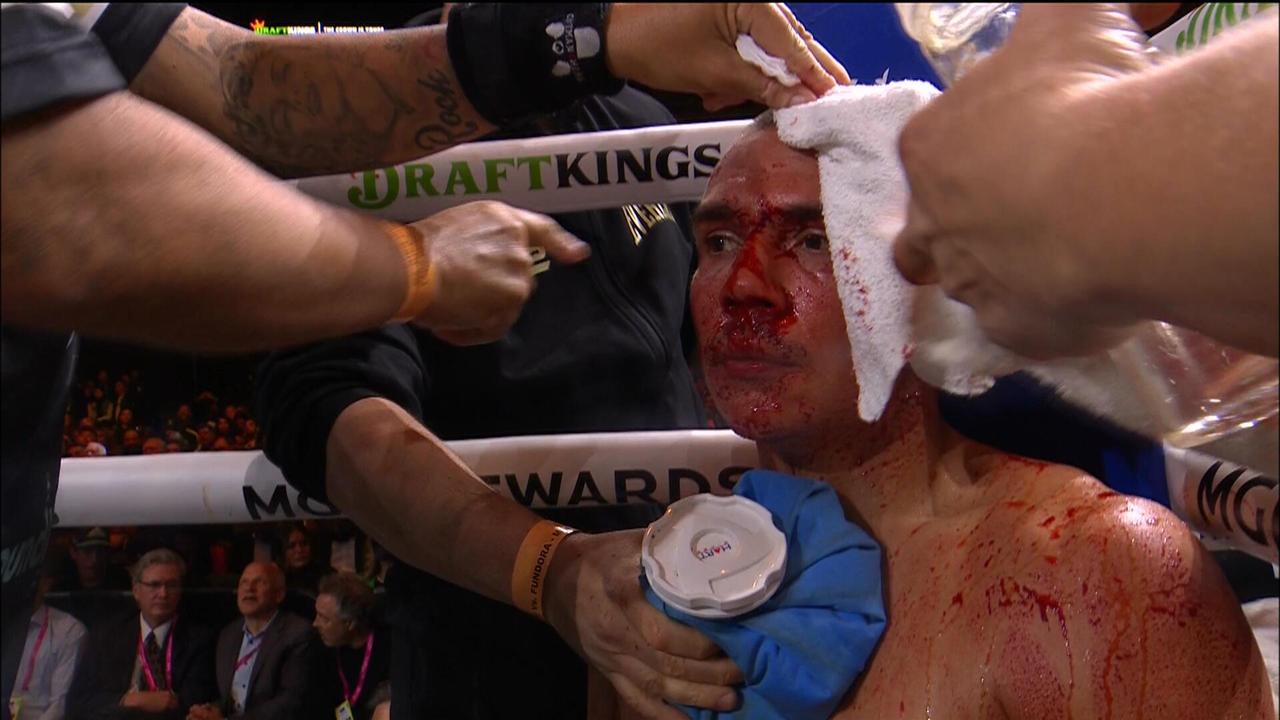 Tim Tszyu was left horribly bloodied.