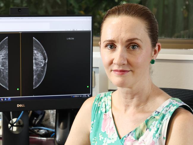 Queensland X Ray will no longer provide breast mammography, imaging or biopsy services to Cairns patients, halving the number of screening services available and causing delays that could place some patients at risk. Surgeon Dr Aemelia Melloy specialises in breast surgery and is concerned that the inevitable delays caused by the lack of screening options will place her patients at significant risk. Picture: Brendan Radke