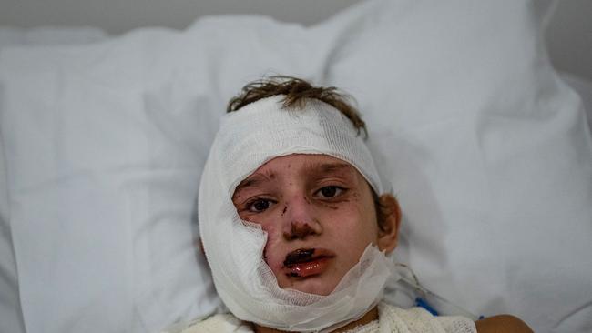 11-year-old Mohammed from Ayn al-Dilib lies in bed at Geitaoui Hospital after receiving serious injuries in an Israeli airstrike in Beirut, Lebanon. Picture: Getty Images