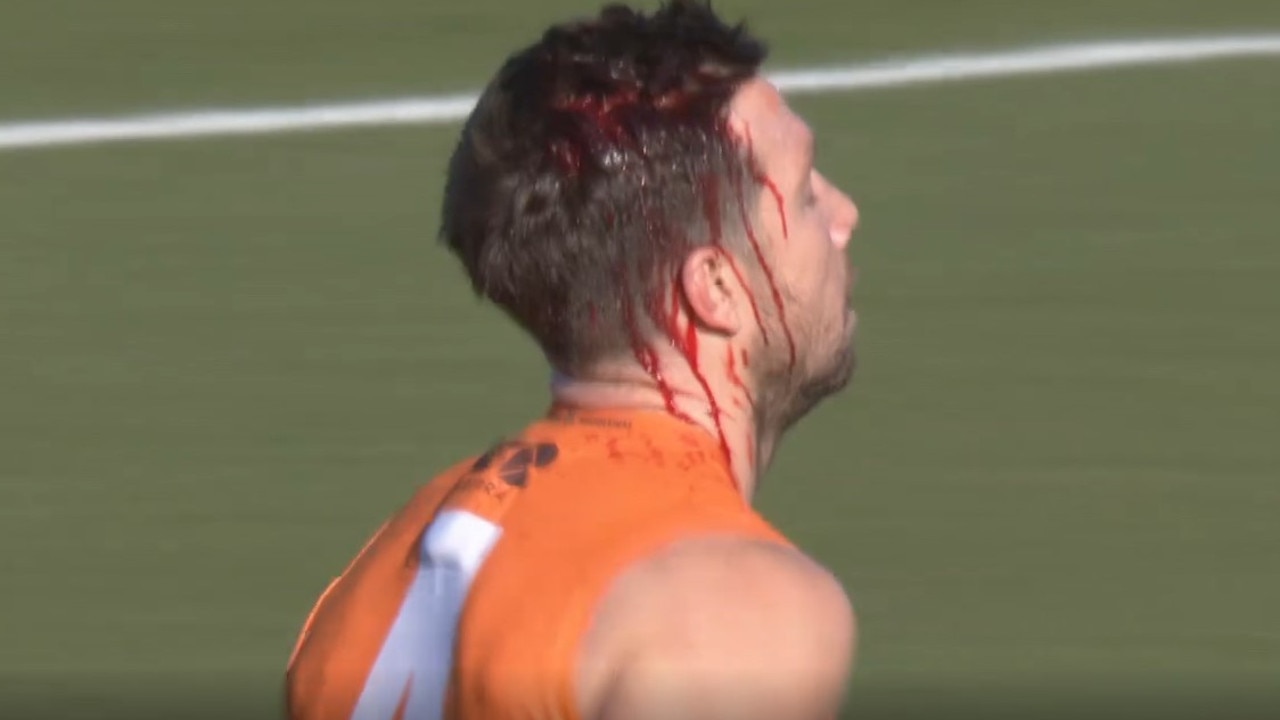 Ouch. Blood pours out of Toby Greene's head. Photo: Fox Footy.