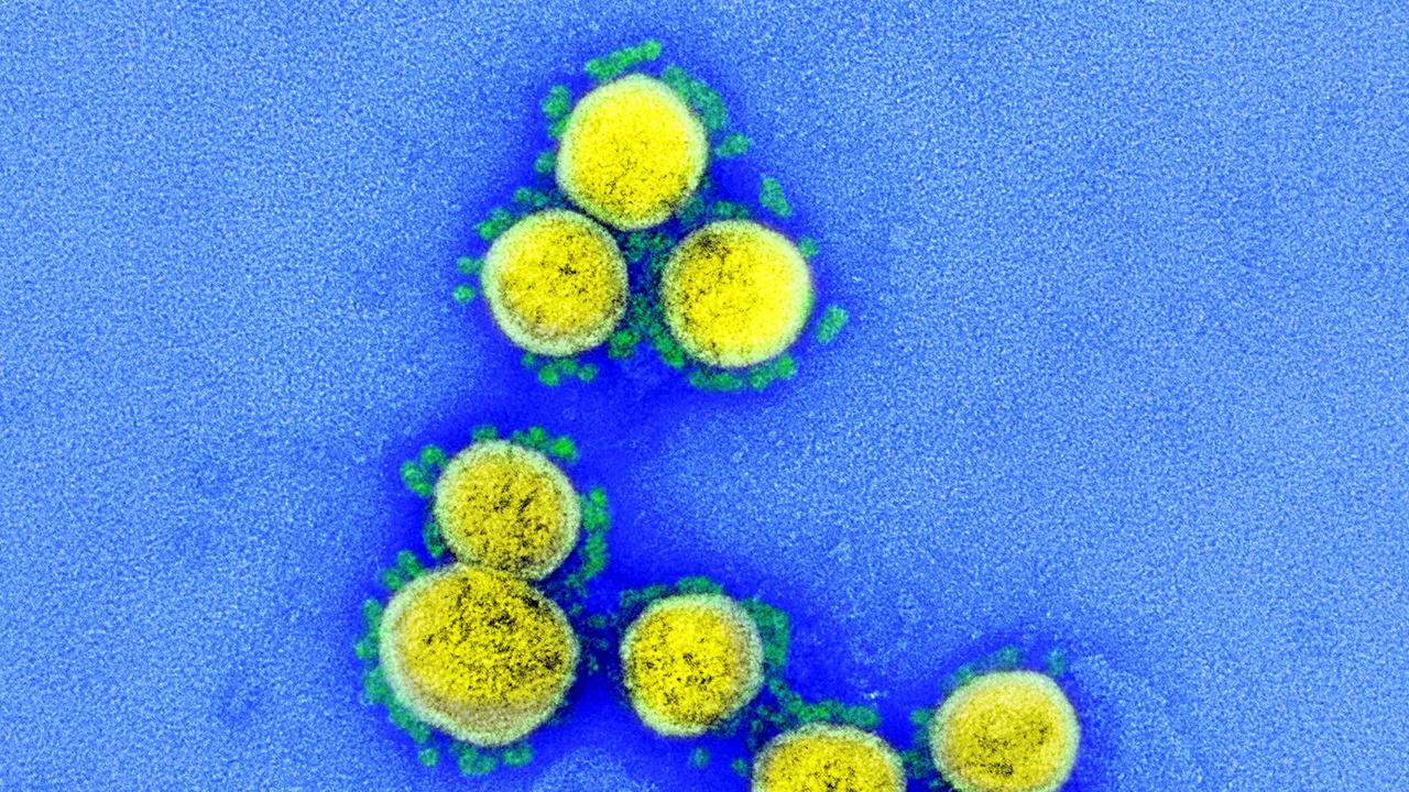 A transmission electron micrograph of SARS-CoV-2 virus particles, isolated from a patient. Picture: AFP