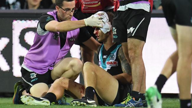 Trainers assist a bloodied Hamish Hartlett.