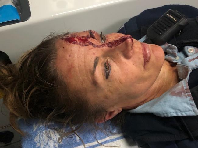 A 47-year-old Senior Constable suffered injuries when she was allegedly assaulted by a man, 28, during an arrest at Halekulani. Picture: NSW Police