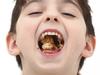 Adorable five year old boy making peanut butter and jelly sandwiches. Jam. Eating. Open mouth. Food. Child. Kids. Children. Food. Royalty free image. Generic image.