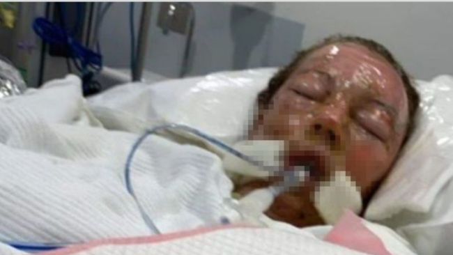 QLD caravan fire Pregnant mum finally wakes up from coma after