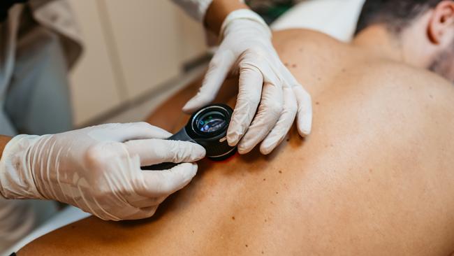 Australia has the highest melanoma rates in the world, and it is the most common form of cancer among Australians aged 20 to 39, with one new diagnosis every 30 minutes and one death every six hours. Picture: Supplied.