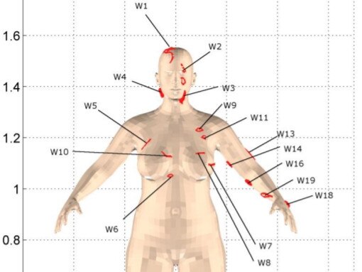 An image from Zac Couper’s report showing some of the wounds Shandee Blackburn suffered.