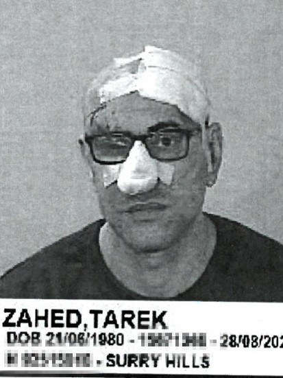 A mug shot of Tarek Zahed showing the injuries he sustained during the Auburn gym shooting, where his brother was killed.