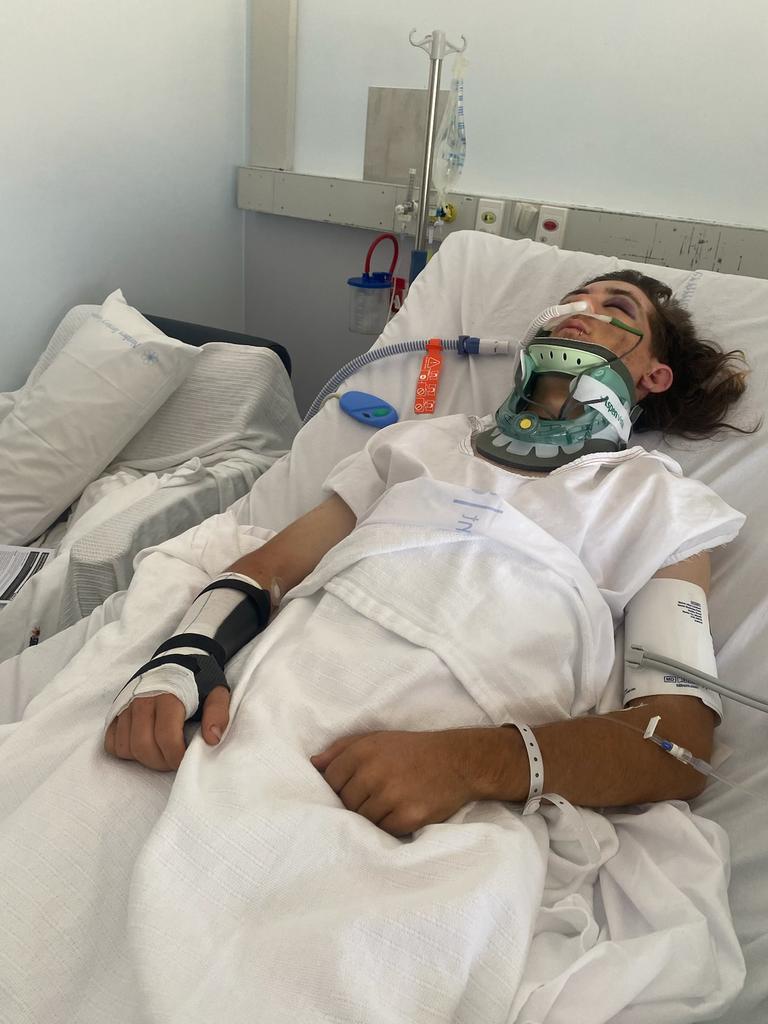 Nate Chapman, 17, was lucky to escape with his life after a nasty crash 150km from Darwin left him in a critical condition and no CareFlight came to help. Picture: Supplied.