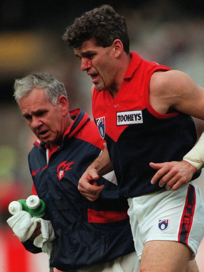 A bloodied Smith leaves the field during a 1997 clash with Collingwood.