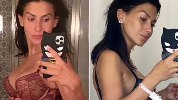 Hilaria Baldwin shares post-baby bod one day after giving birth.