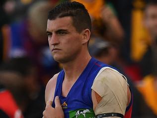 Tom Rockliff of the Lions is seen after sustaining an injury during the Round 8 AFL match between the Hawthorn Hawks and the Brisbane Lions at the University of Tasmania Stadium in Launceston, Saturday, May 13, 2017. (AAP Image/Julian Smith) NO ARCHIVING, EDITORIAL USE ONLY