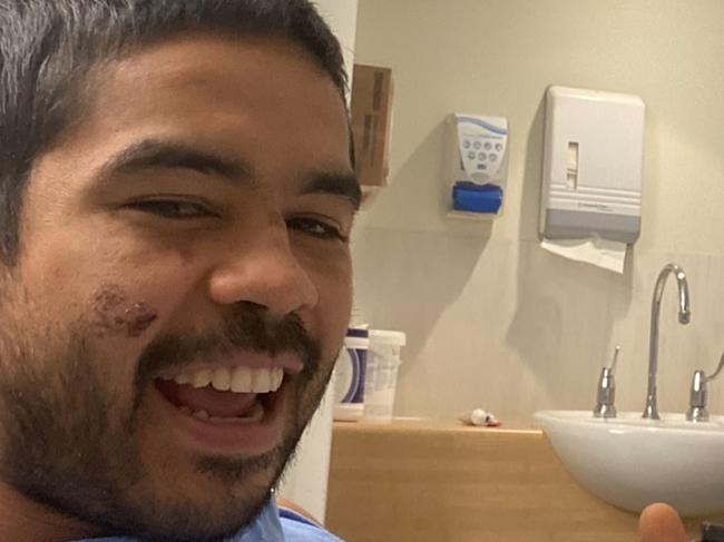 MMA fighter Daniel Williams, also known as Mini T, is recovering in hospital learning how to walk again after a car crash almost claimed his life. Picture: Instagram