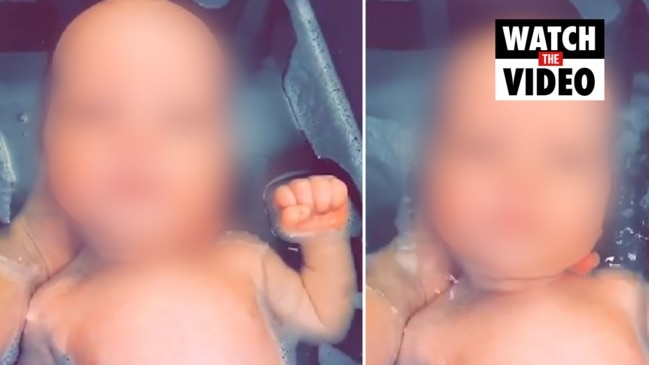 Mum gives baby 'bleach baths' to help skin